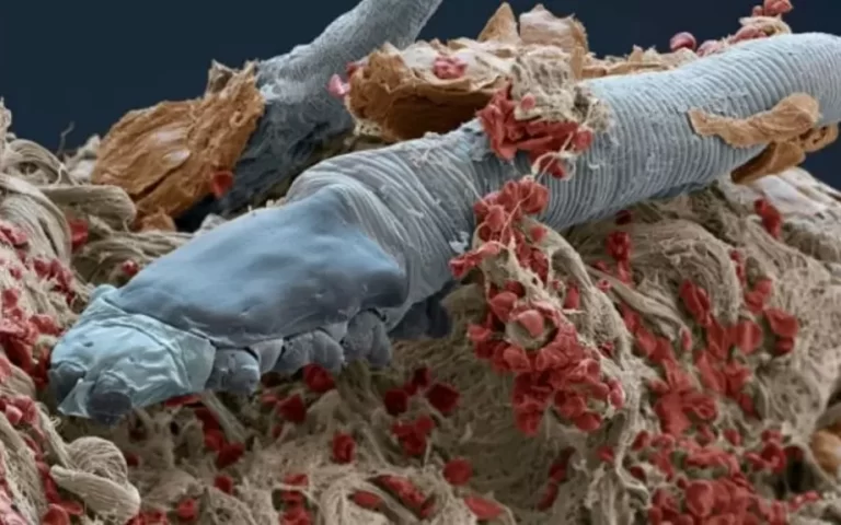 Creatures Living on Our Face: Demodex Maggots 67 yuzumuzde yasayan canlilar2 1024x575.webp