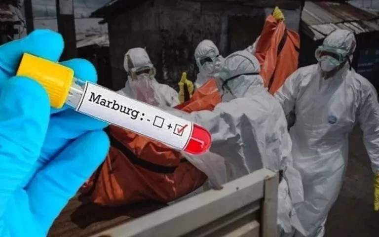Health Authorities Alarmed! Ebola-Like Virus Spreads by Contact, Mortality Rate is High! 65 Marburg virusu1.webp
