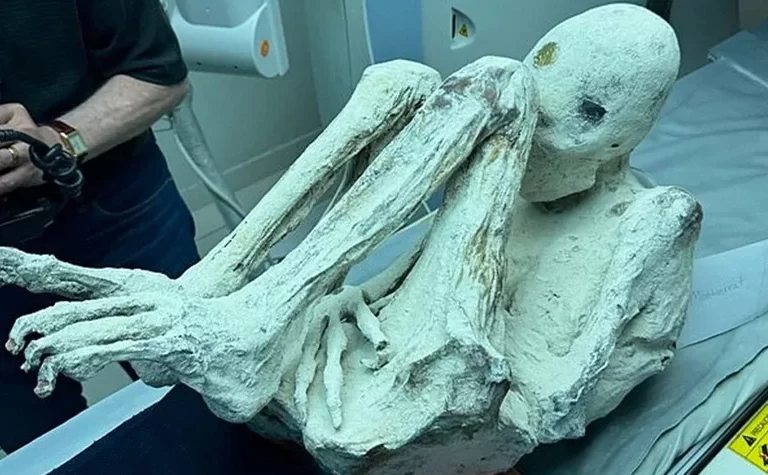 Three-Toed Mummies in the Nazca Desert: Scientific Studies and Alien Claims! 145 Nazca Colundeki Uc Parmakli Mumyalar4.webp
