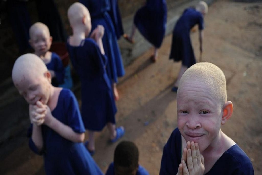 albino