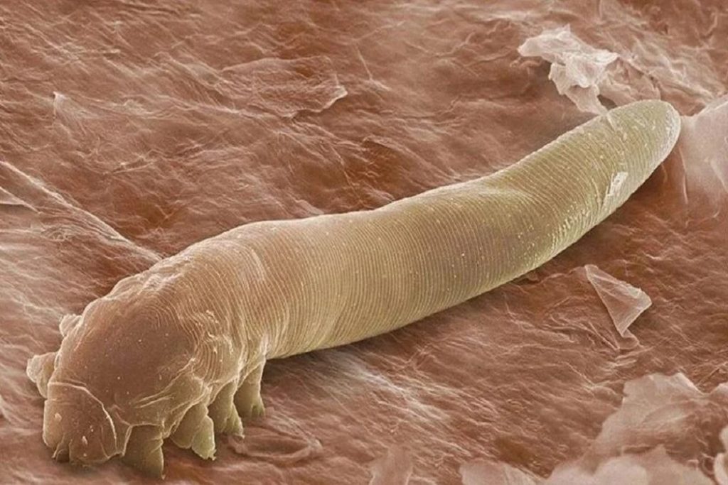 Demodex