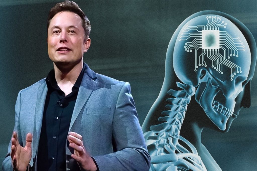 Neuralink Beyin Çipi